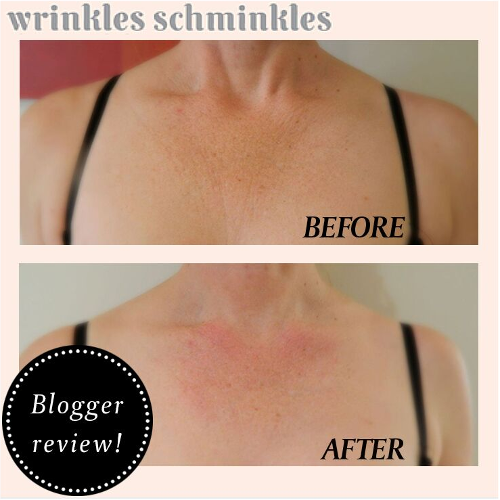 Wrinkles Schminkles Chest Smoothing Kit